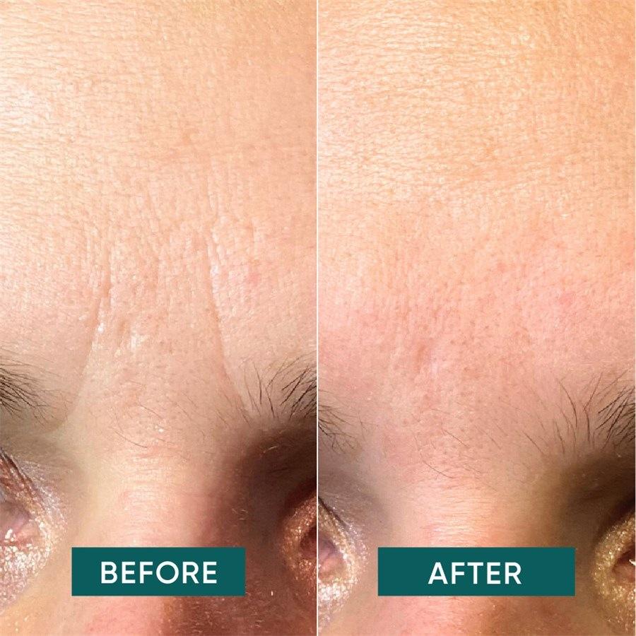 Gesicht Facial Patches Niacinamide - it’s a skin-vestment von APRICOT Tägliche Deals