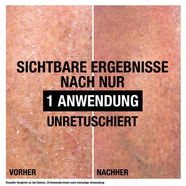 bodyguardapotheke NEUTROGENA Intense Repair CICA Bodybalsam Black Friday