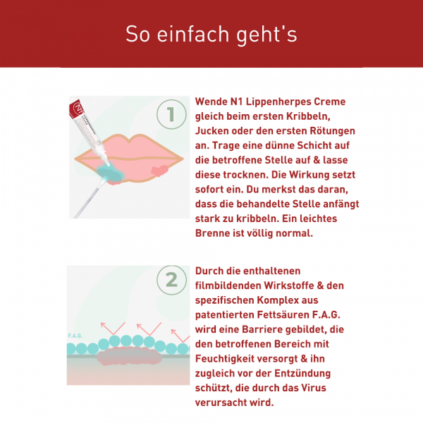 bodyguardapotheke N1 LIPPENHERPES Creme Großer Ausverkauf