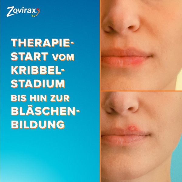 bodyguardapotheke ZOVIRAX Lippenherpes Creme Cyber Monday