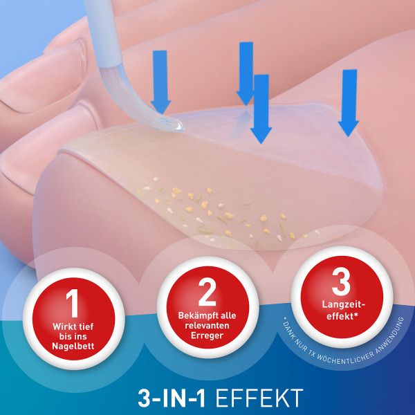 bodyguardapotheke LOCERYL Nagellack gegen Nagelpilz DIREKT-Applikat Letzte 2 Tage