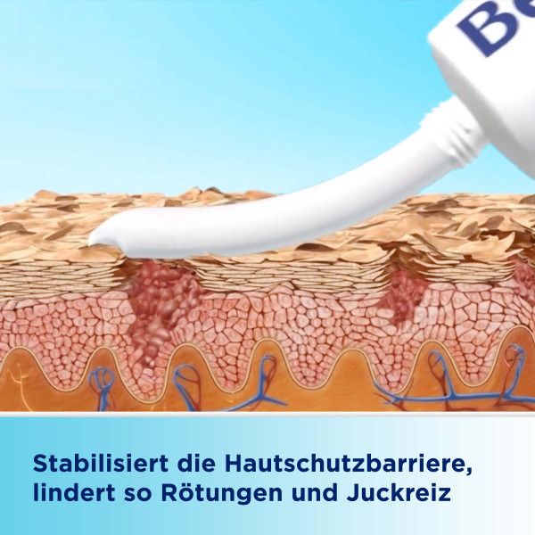 bodyguardapotheke BEPANTHEN Sensiderm Creme zur Linderung bei geröteten juckenden Hautstellen durch Stabilisierung der Hautbarriere Muttertagsangebot