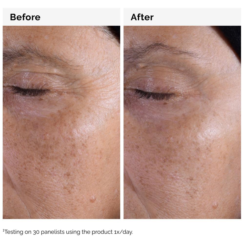 lookfantastic The Ordinary Glycolic Acid 7% Peeling-Toner 240 ml Weihnachtsangebot