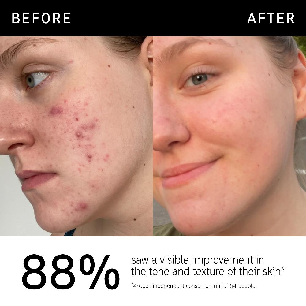 lookfantastic The INKEY List 15% Vitamin C und EGF Serum 30 ml Exklusive Angebote