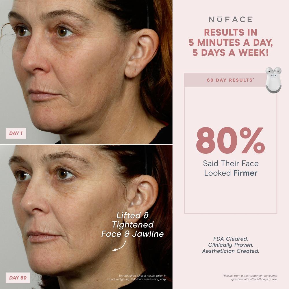 lookfantastic NuFACE® Mini Starterkit Begrenztes Angebot