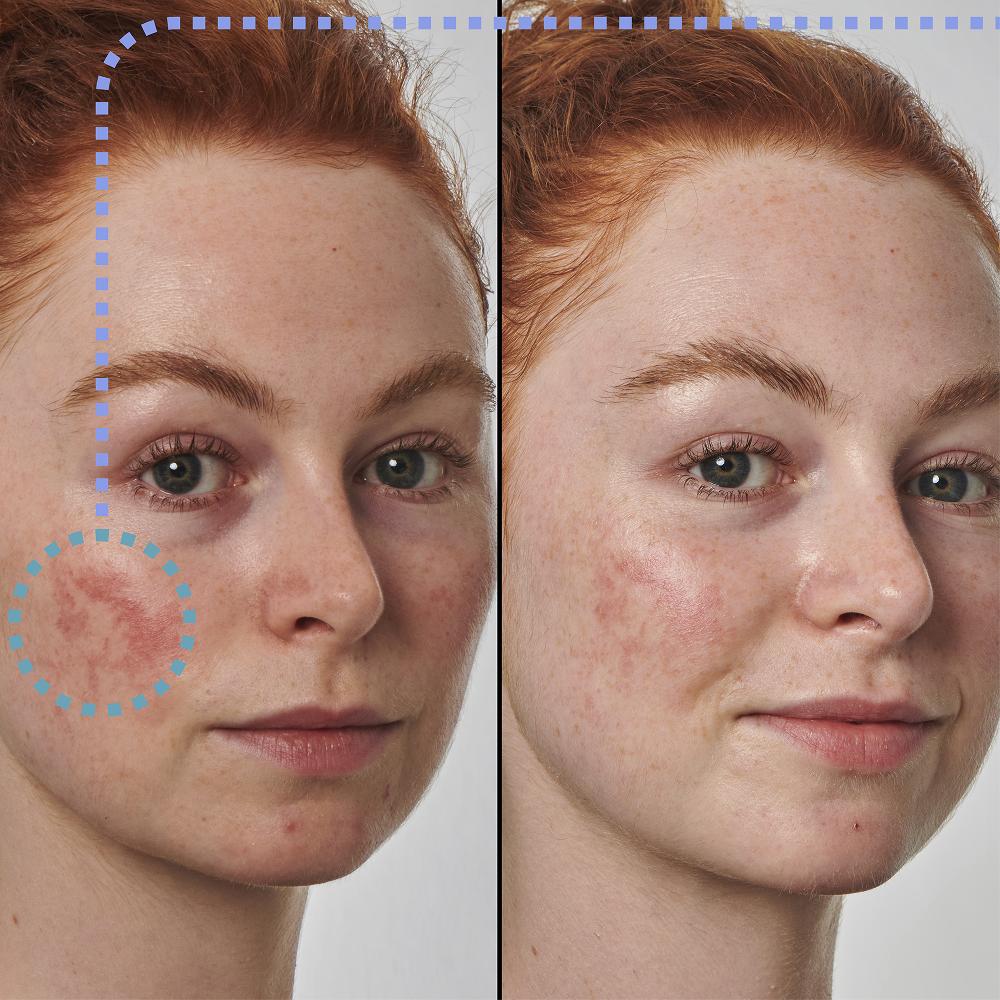 lookfantastic The INKEY List Super Solutions 10 % Azelainsäure-Serum 30 ml Angebote