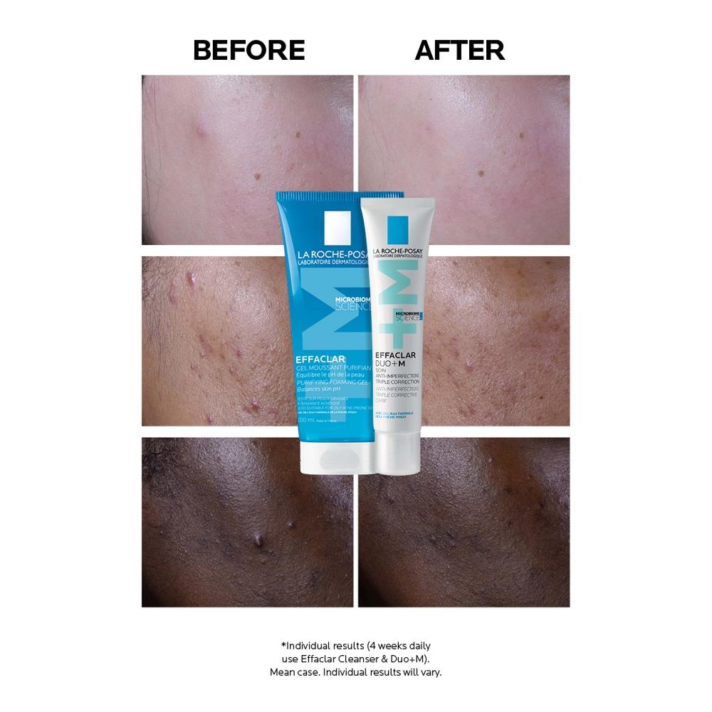 lookfantastic La Roche-Posay Effaclar Duo+M Unreinheitenkorrigierende Gel-Feuchtigkeitspflege für Fettige zu Unreinheiten Neigende Haut 40 ml Online