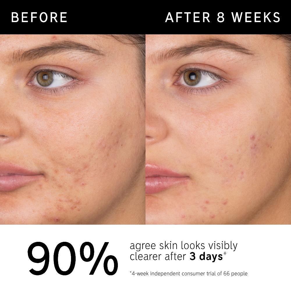 lookfantastic The INKEY List Salizylsäure-Gesichtsreinigung 60 ml Nur noch ein Tag übrig