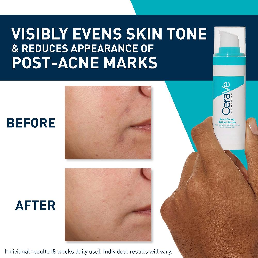 lookfantastic CeraVe Resurfacing Retinol Serum with Ceramides and Niacinamide for Blemish-Prone Skin 30ml Saisonale Angebote