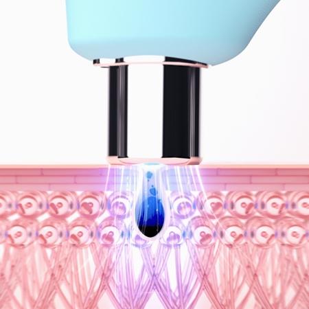 FOREO FOREO KIWI™ Vakuum-Mitesserentferner mit blauem LED-Licht Limitierter Zeitrabatt